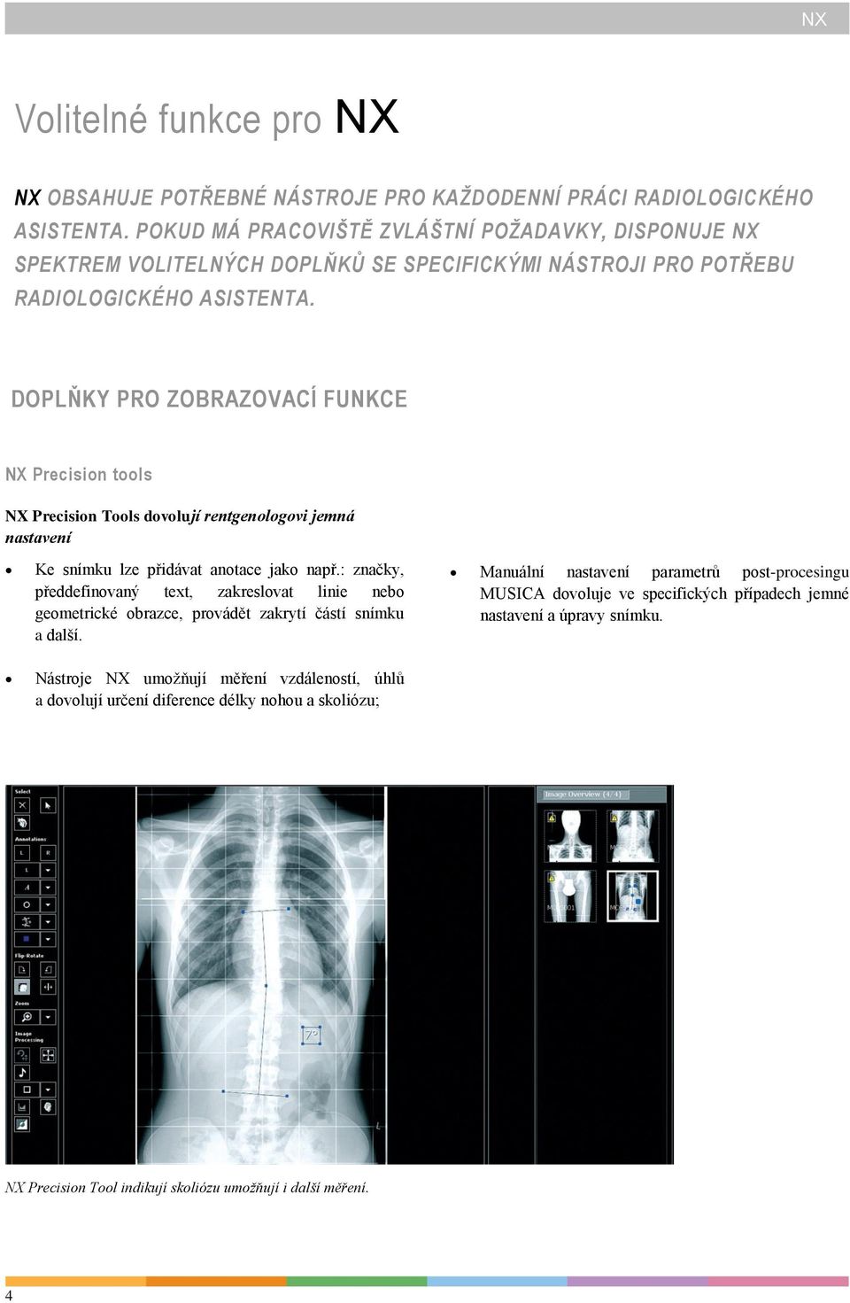 DOPLŇKY PRO ZOBRAZOVACÍ FUNKCE NX Precision tools NX Precision Tools dovolují rentgenologovi jemná nastavení Ke snímku lze přidávat anotace jako např.