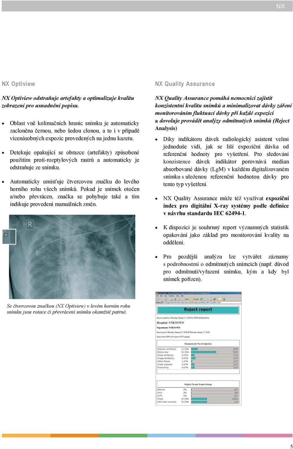 Detekuje opakující se obrazce (artefakty) způsobené použitím proti-rozptylových rastrů a automaticky je odstraňuje ze snímku.