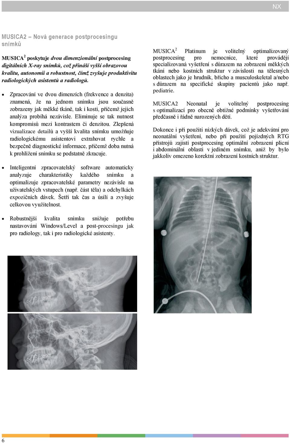 Zpracování ve dvou dimenzích (frekvence a denzita) znamená, že na jednom snímku jsou současně zobrazeny jak měkké tkáně, tak i kosti, přičemž jejich analýza probíhá nezávisle.