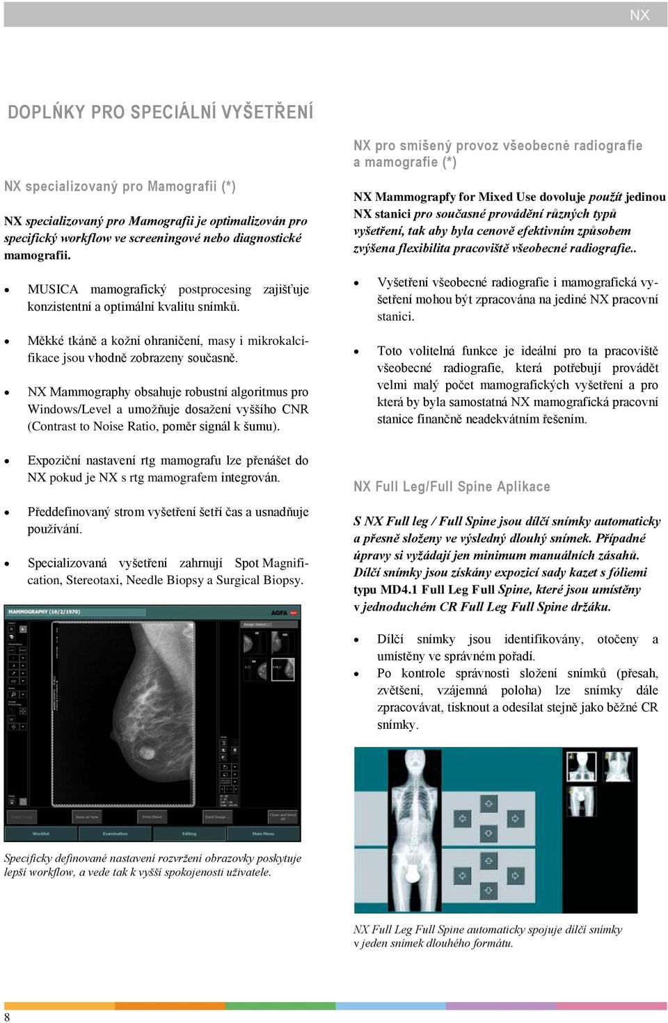 efektivním způsobem zvýšena flexibilita pracoviště všeobecné radiografie.. MUSICA mamografický postprocesing zajišťuje konzistentní a optimální kvalitu snímků.