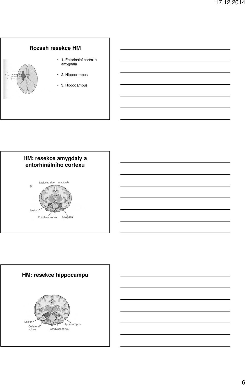 Hippocampus 3.