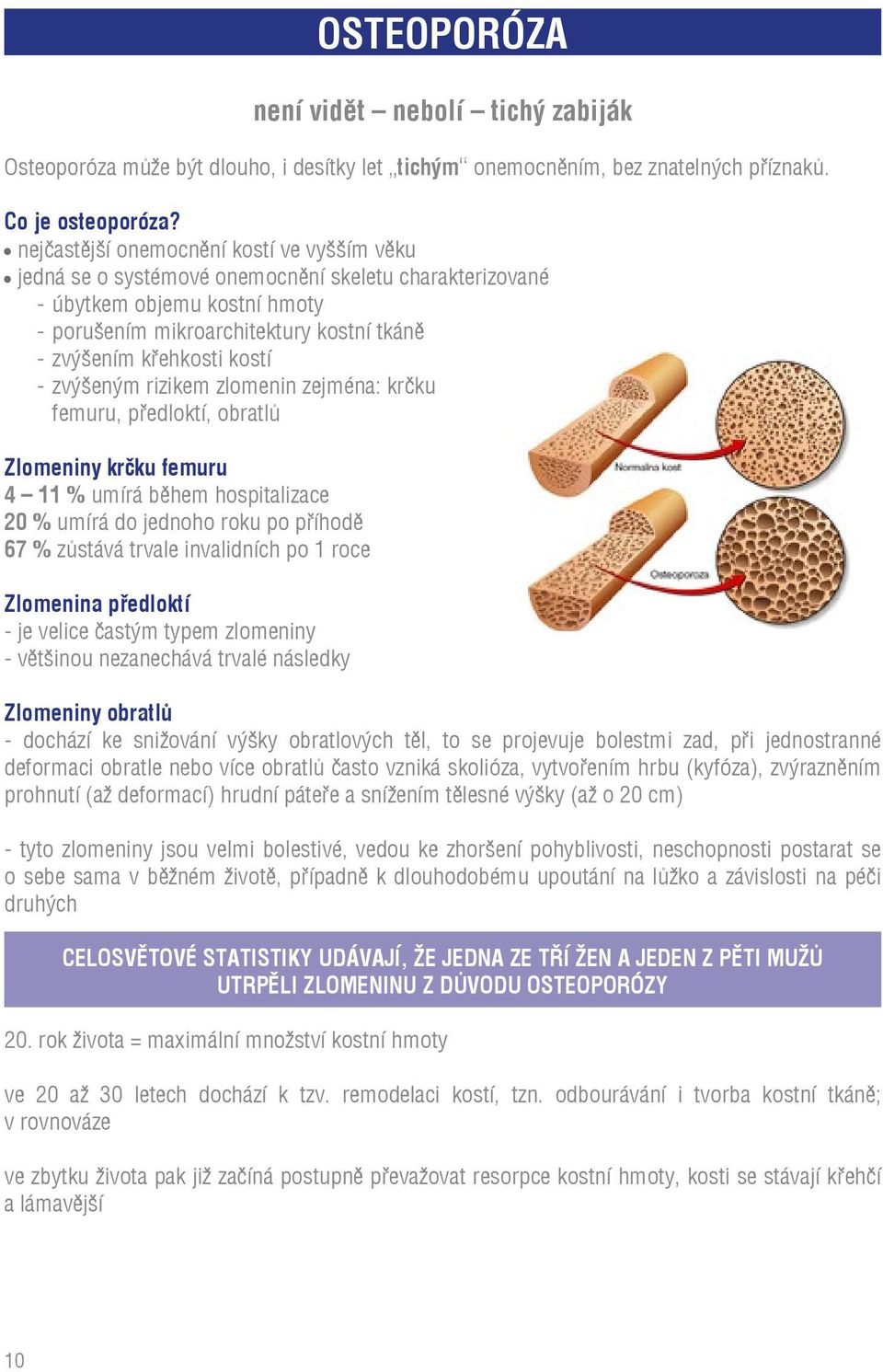 kostí - zvýšeným rizikem zlomenin zejména: krčku femuru, předloktí, obratlů Zlomeniny krčku femuru 4 11 % umírá během hospitalizace 20 % umírá do jednoho roku po příhodě 67 % zůstává trvale