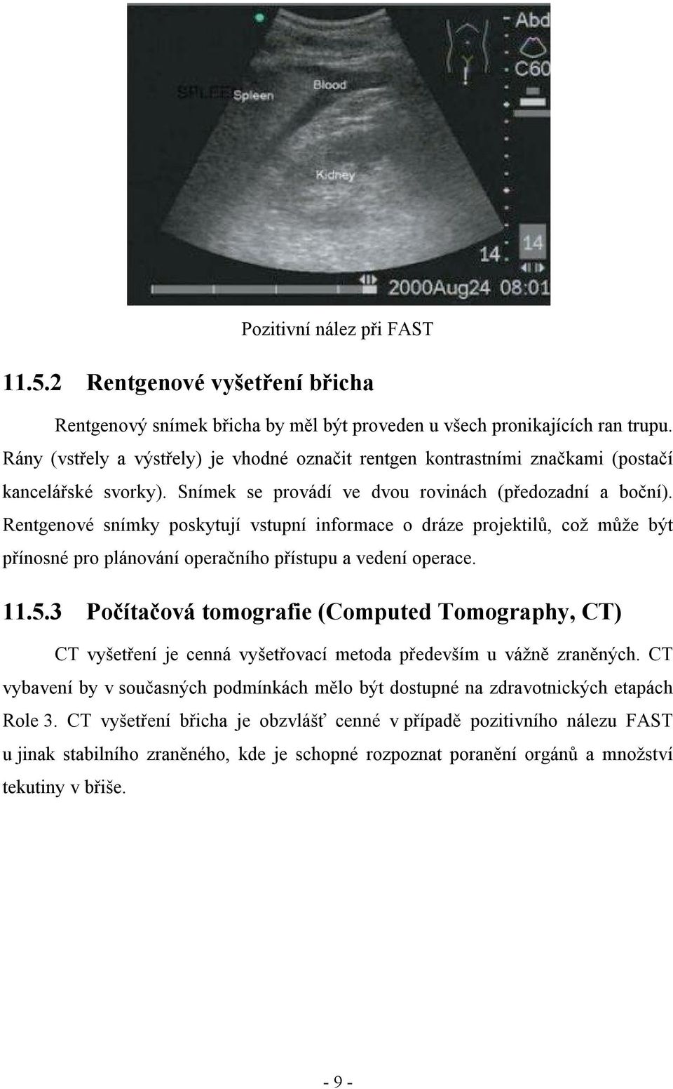 Rentgenové snímky poskytují vstupní informace o dráze projektilů, což může být přínosné pro plánování operačního přístupu a vedení operace. 11.5.