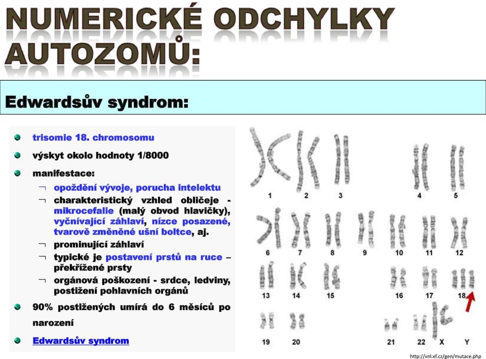 mikrocefalie (malý obvod hlavičky), vyčnívající záhlaví, nízce posazené, tvarově změněné ušní boltce, aj.