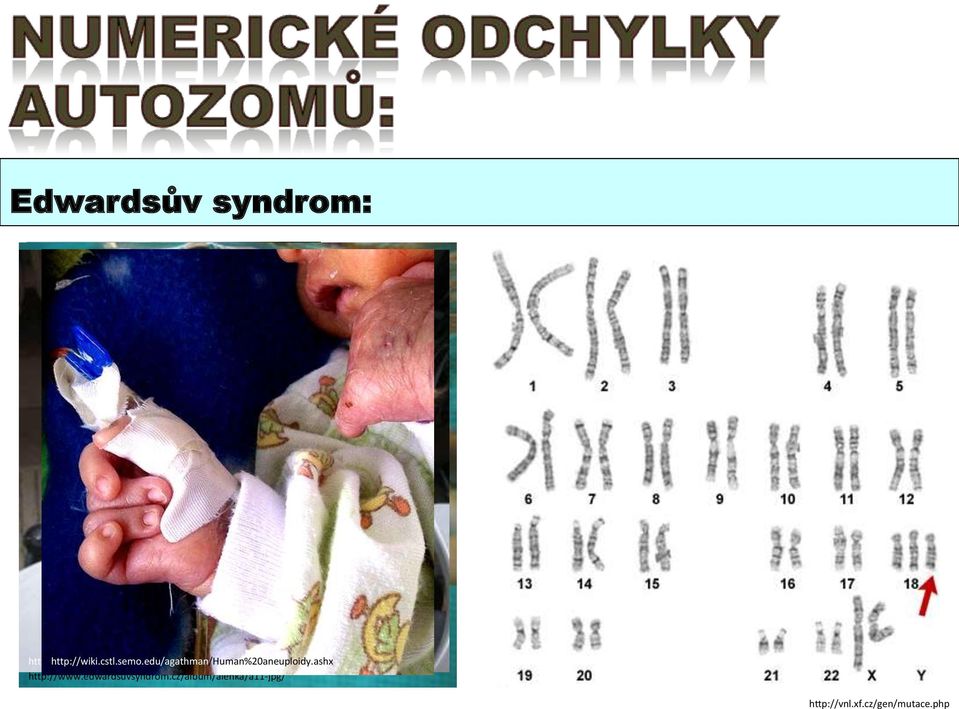 edu/agathman/human%20aneuploidy.ashx http://hayden-october-2006.