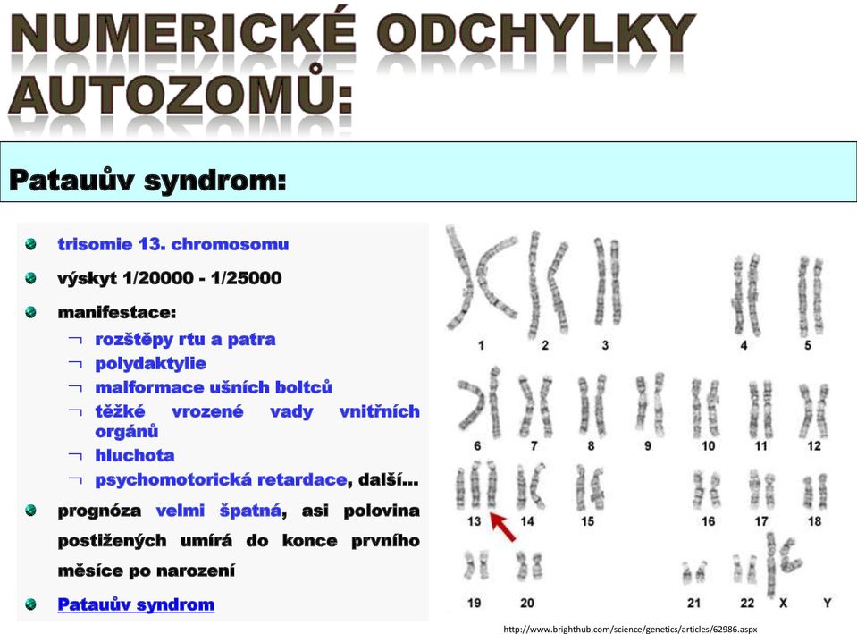 ušních boltců těžké vrozené vady vnitřních orgánů hluchota psychomotorická retardace, další.