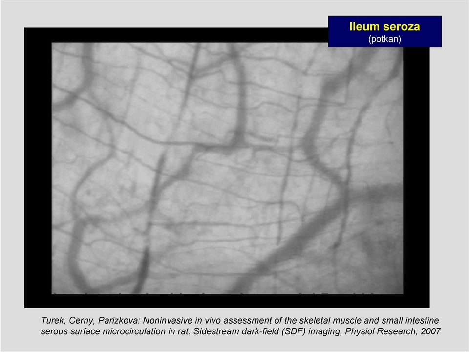and small intestine serous surface microcirculation in