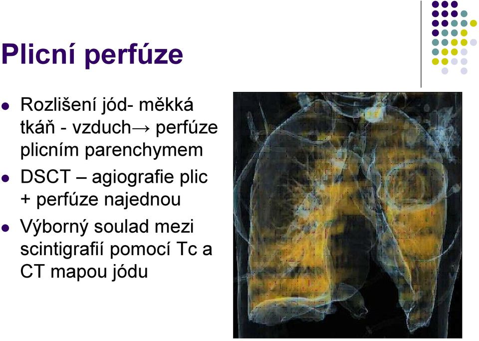 agiografie plic + perfúze najednou Výborný
