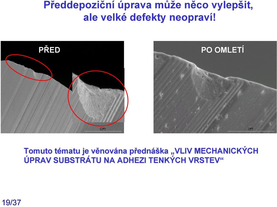 PŘED PO OMLETÍ Tomuto tématu je věnována