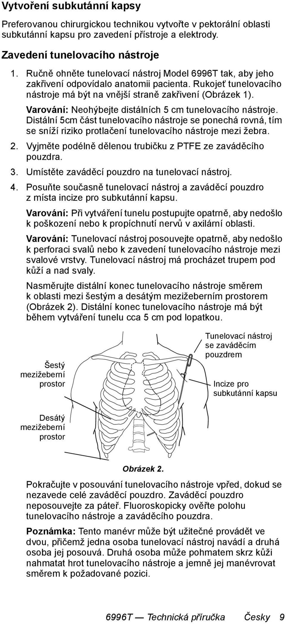 Varování: Neohýbejte distálních 5 cm tunelovacího nástroje. Distální 5cm část tunelovacího nástroje se ponechá rovná, tím se sníží riziko protlačení tunelovacího nástroje mezi žebra. 2.