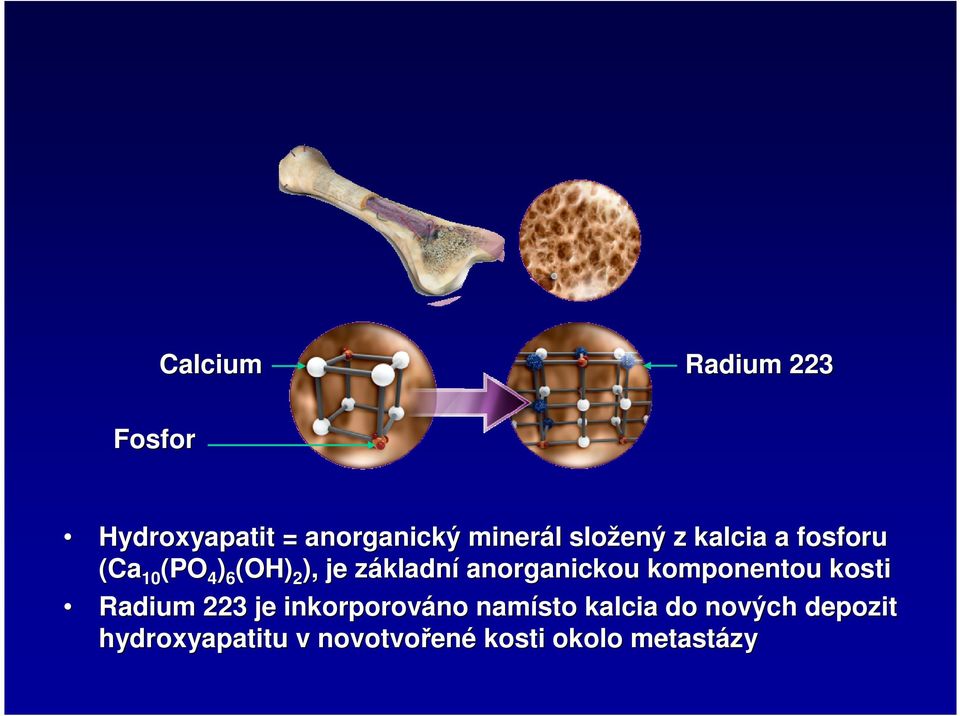 anorganickou komponentou kosti Radium 223 je inkorporováno no namísto