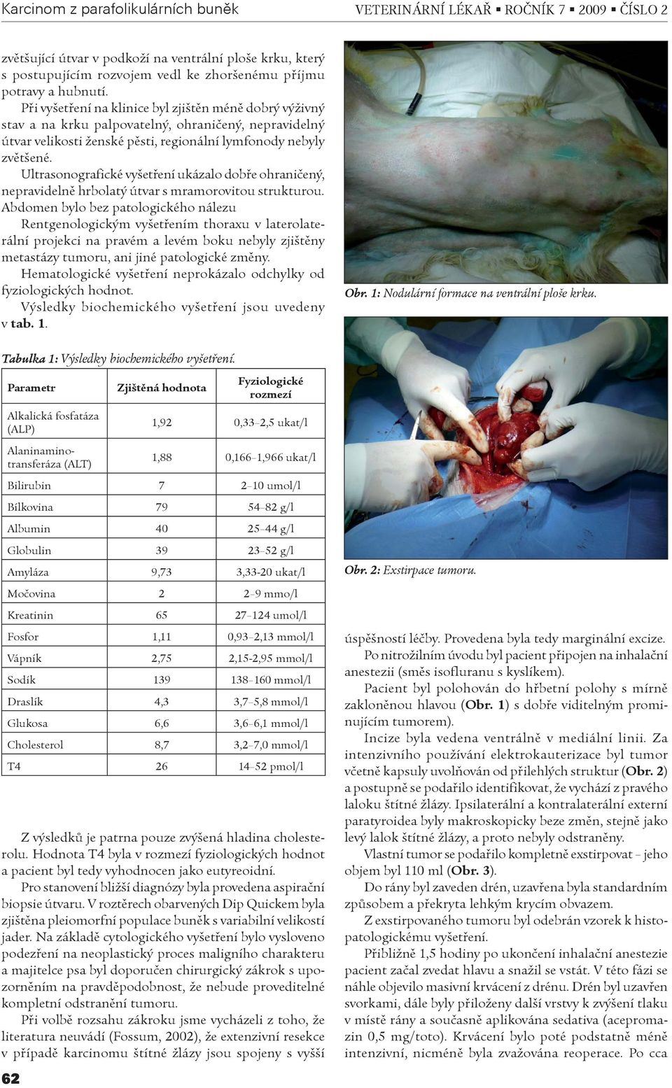 Ultrasonografické vyšetøení ukázalo dobøe ohranièený, nepravidelnì hrbolatý útvar s mramorovitou strukturou.