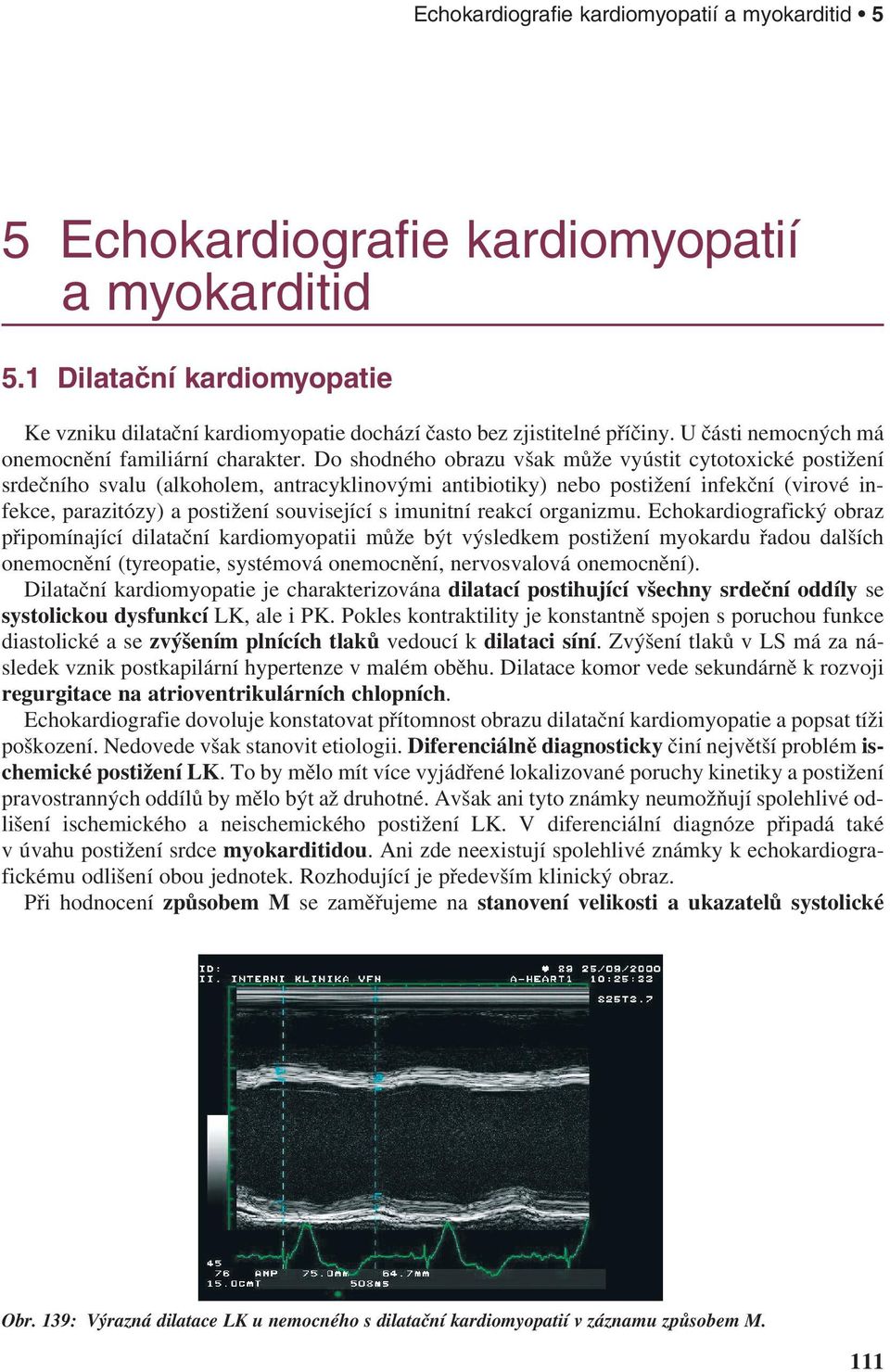 Do shodného obrazu však může vyústit cytotoxické postižení srdečního svalu (alkoholem, antracyklinovými antibiotiky) nebo postižení infekční (virové infekce, parazitózy) a postižení související s