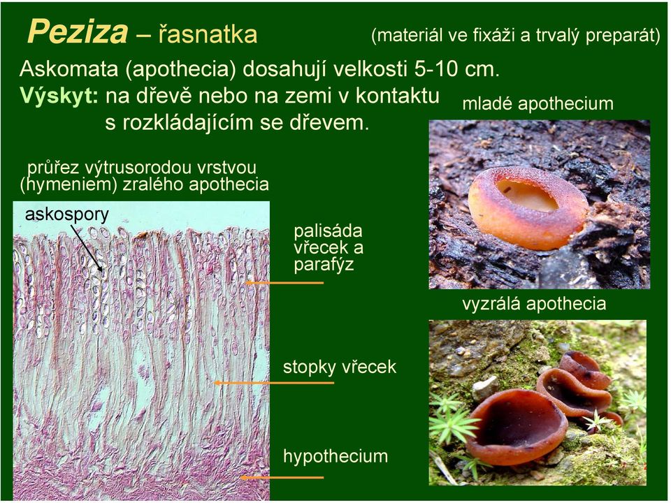 (materiál ve fixáži a trvalý preparát) mladé apothecium průřez výtrusorodou