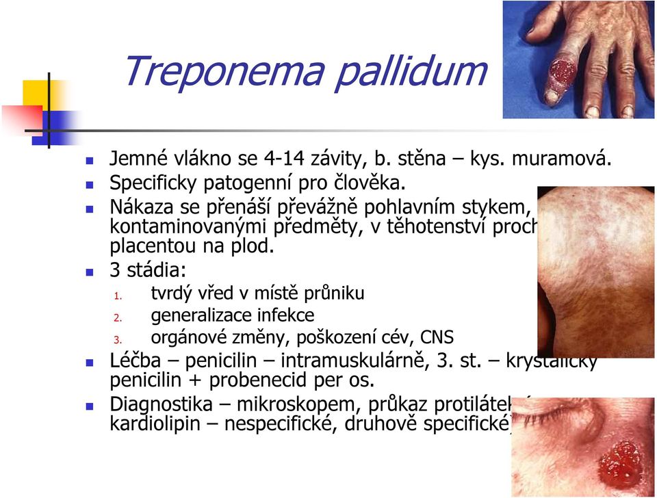 3 stádia: 1. tvrdý vřed v místě průniku 2. generalizace infekce 3.