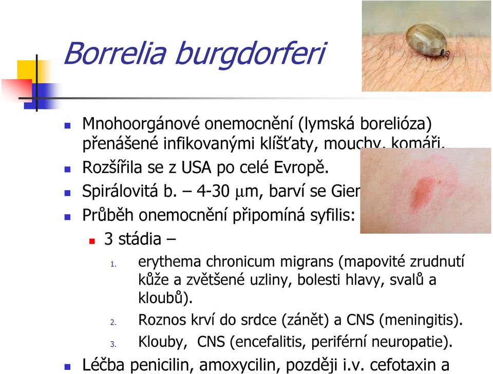 erythema chronicum migrans (mapovité zrudnutí kůže a zvětšené uzliny, bolesti hlavy, svalů a kloubů). 2.