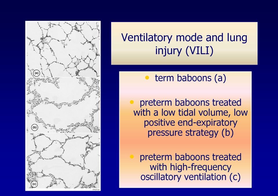 positive end-expiratory pressure strategy (b) preterm