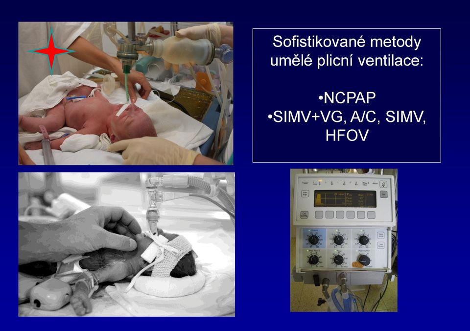 plicní ventilace: