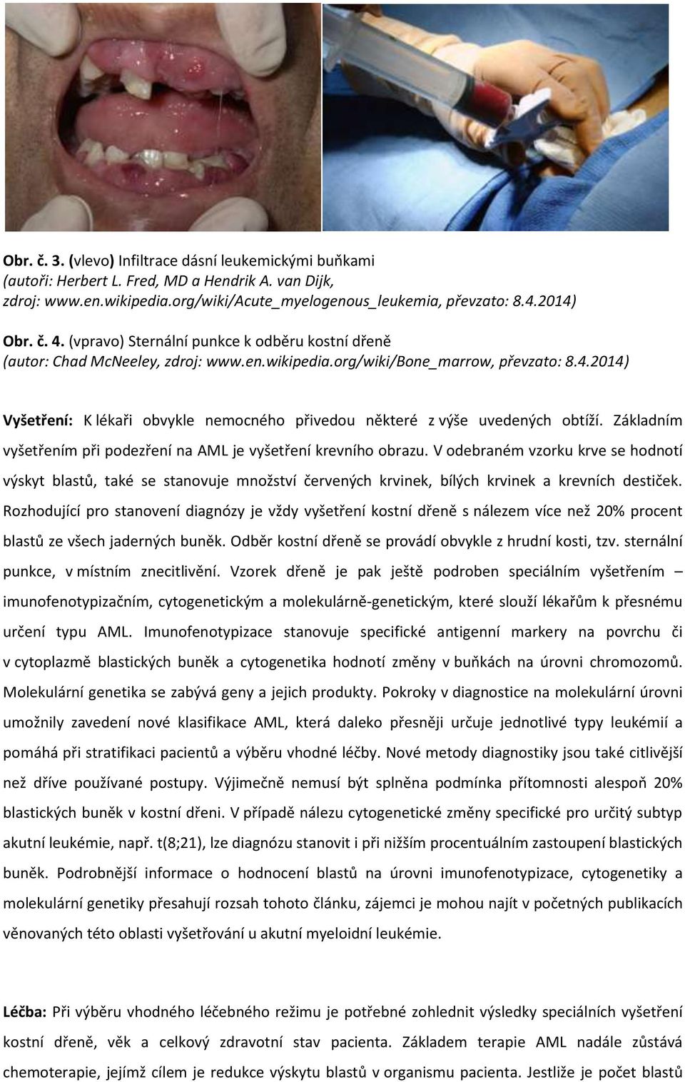 2014) Vyšetření: K lékaři obvykle nemocného přivedou některé z výše uvedených obtíží. Základním vyšetřením při podezření na AML je vyšetření krevního obrazu.