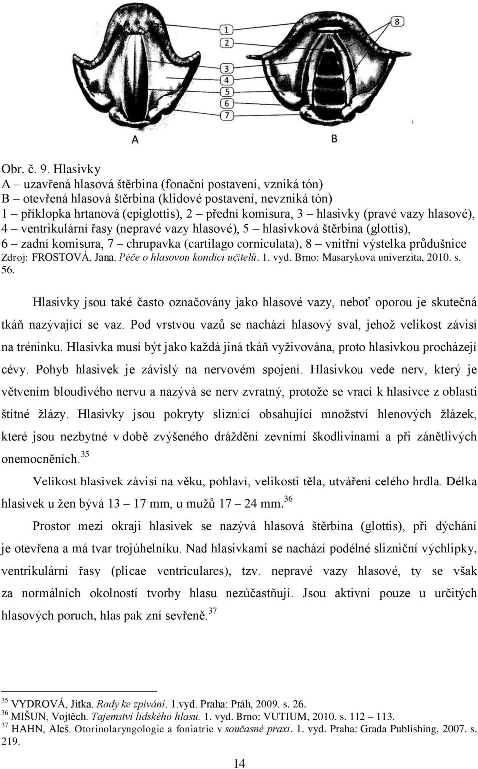 (pravé vazy hlasové), 4 ventrikulární řasy (nepravé vazy hlasové), 5 hlasivková štěrbina (glottis), 6 zadní komisura, 7 chrupavka (cartilago corniculata), 8 vnitřní výstelka průdušnice Zdroj: