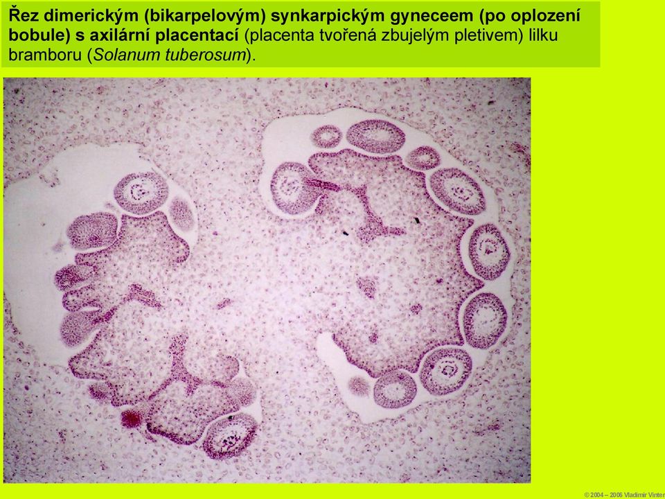 bobule) s axilární placentací (placenta