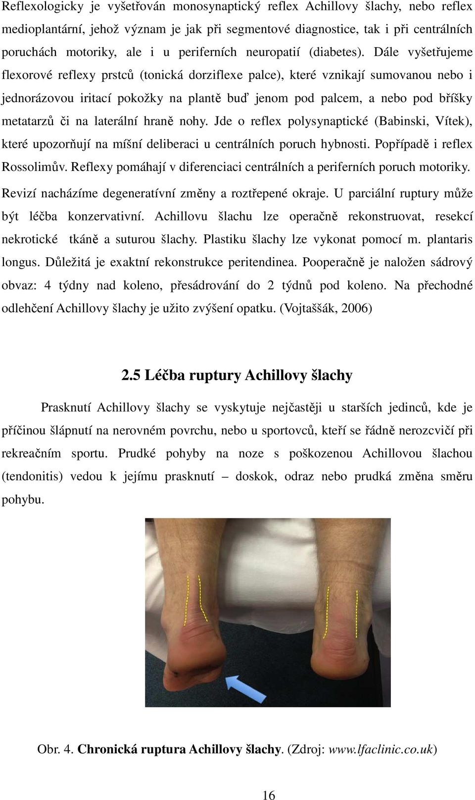 Dále vyšetřujeme flexorové reflexy prstců (tonická dorziflexe palce), které vznikají sumovanou nebo i jednorázovou iritací pokožky na plantě buď jenom pod palcem, a nebo pod bříšky metatarzů či na