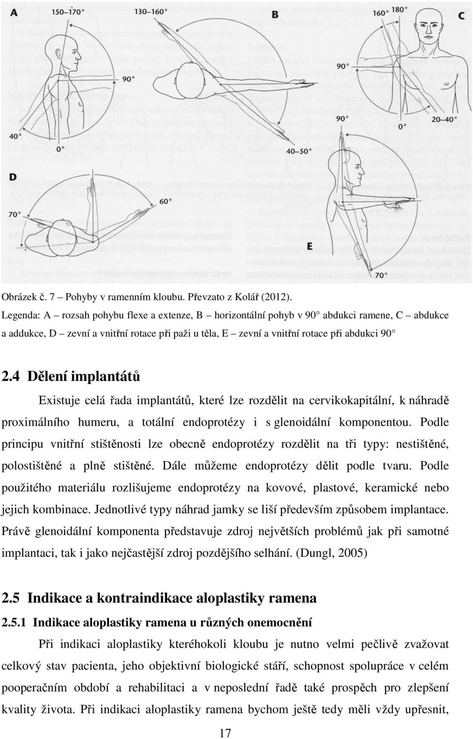 4 Dělení implantátů Existuje celá řada implantátů, které lze rozdělit na cervikokapitální, k náhradě proximálního humeru, a totální endoprotézy i s glenoidální komponentou.
