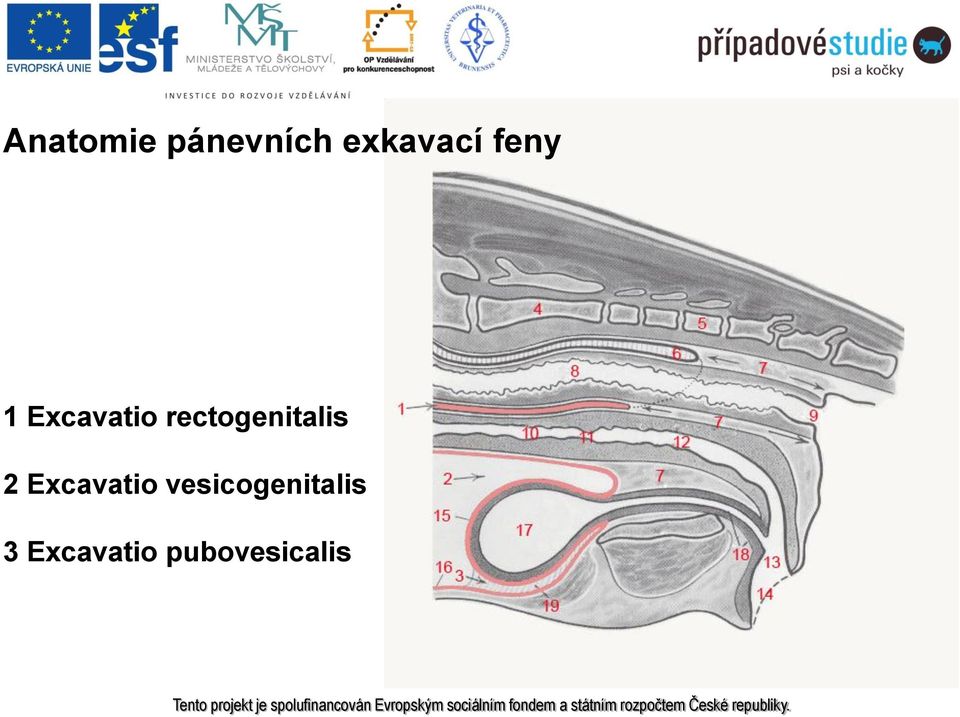 rectogenitalis 2 Excavatio