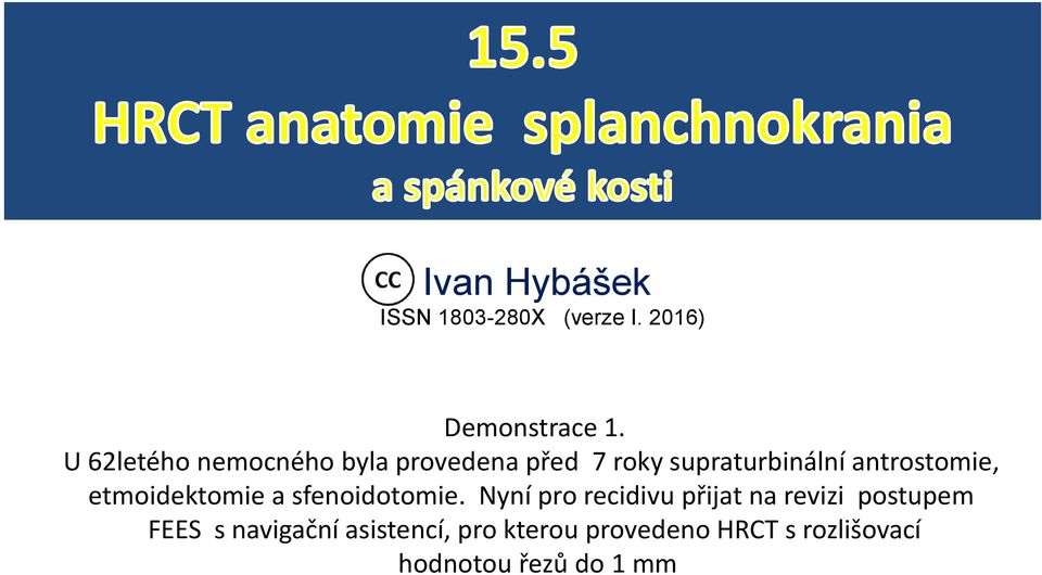 antrostomie, etmoidektomie a sfenoidotomie.