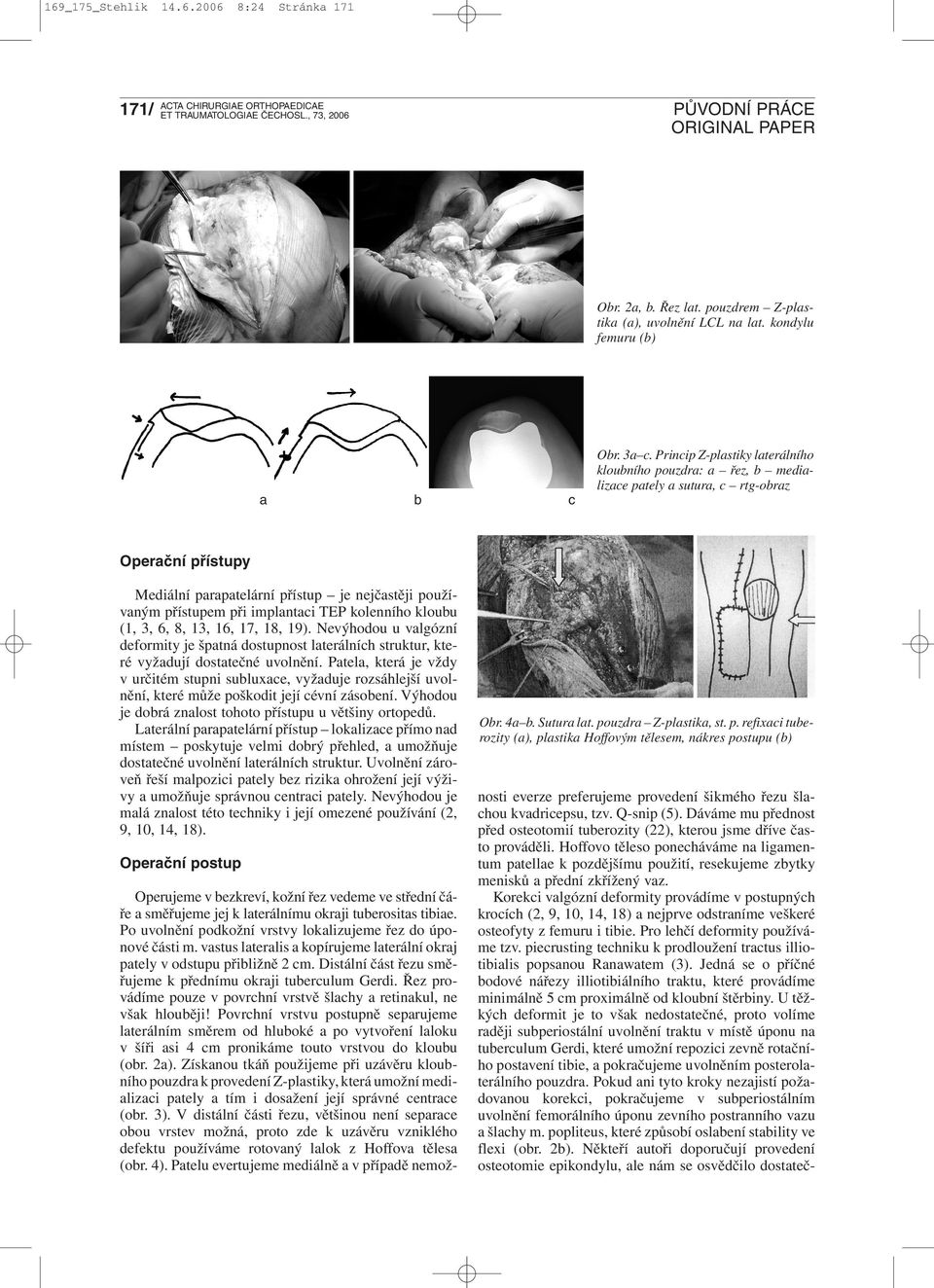 TEP kolenního kloubu (1, 3, 6, 8, 13, 16, 17, 18, 19). Nevýhodou u valgózní deformity je špatná dostupnost laterálních struktur, které vyžadují dostatečné uvolnění.