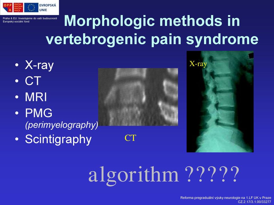 X-ray CT MRI PMG