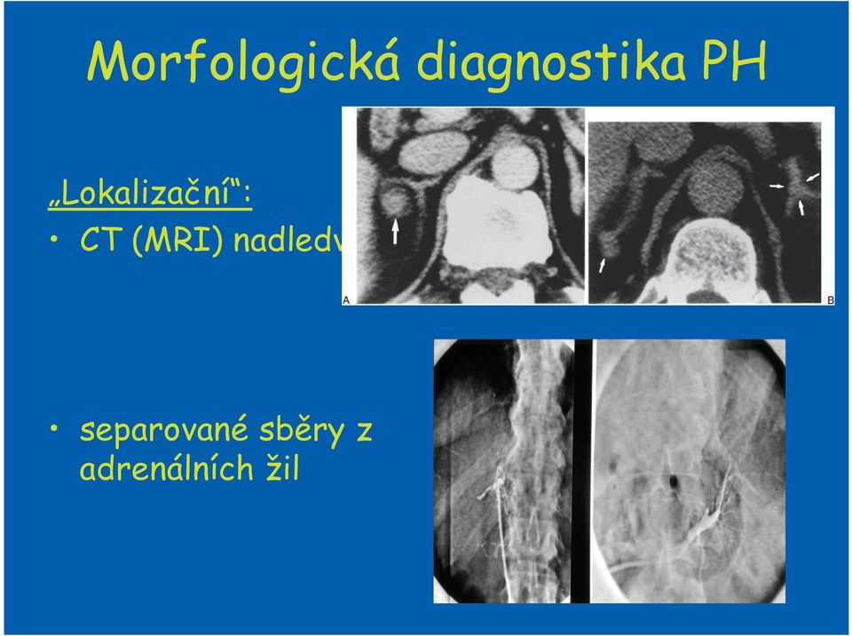 Lokalizační : CT (MRI)
