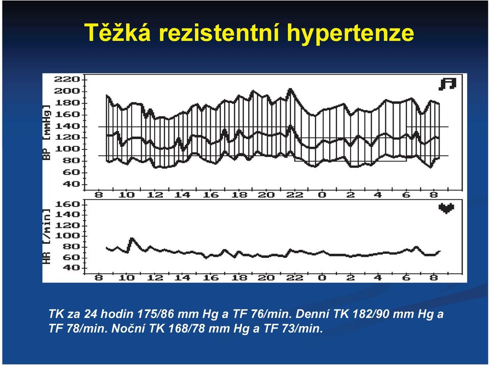 Denní TK 182/90 mm Hg a TF 78/min.