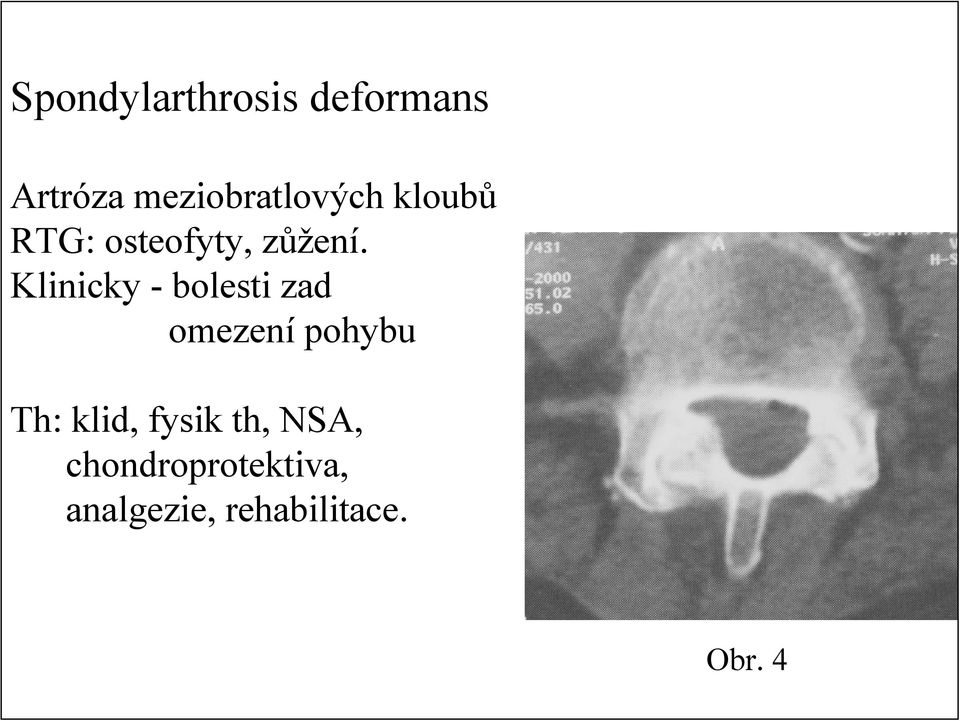 Klinicky - bolesti zad omezení pohybu Th: klid,