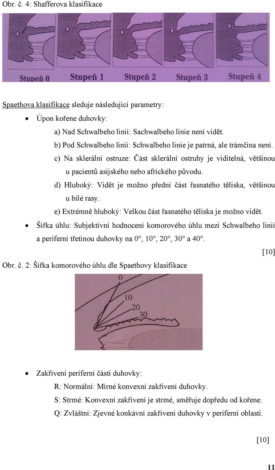 d) Hluboký: Vidět je moţno přední část řasnatého tělíska, většinou u bílé rasy. e) Extrémně hluboký: Velkou část řasnatého tělíska je moţno vidět.