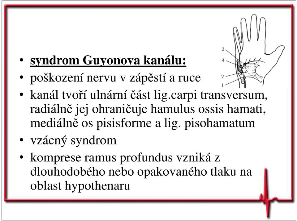 carpi transversum, radiálně jej ohraničuje hamulus ossis hamati, mediálně