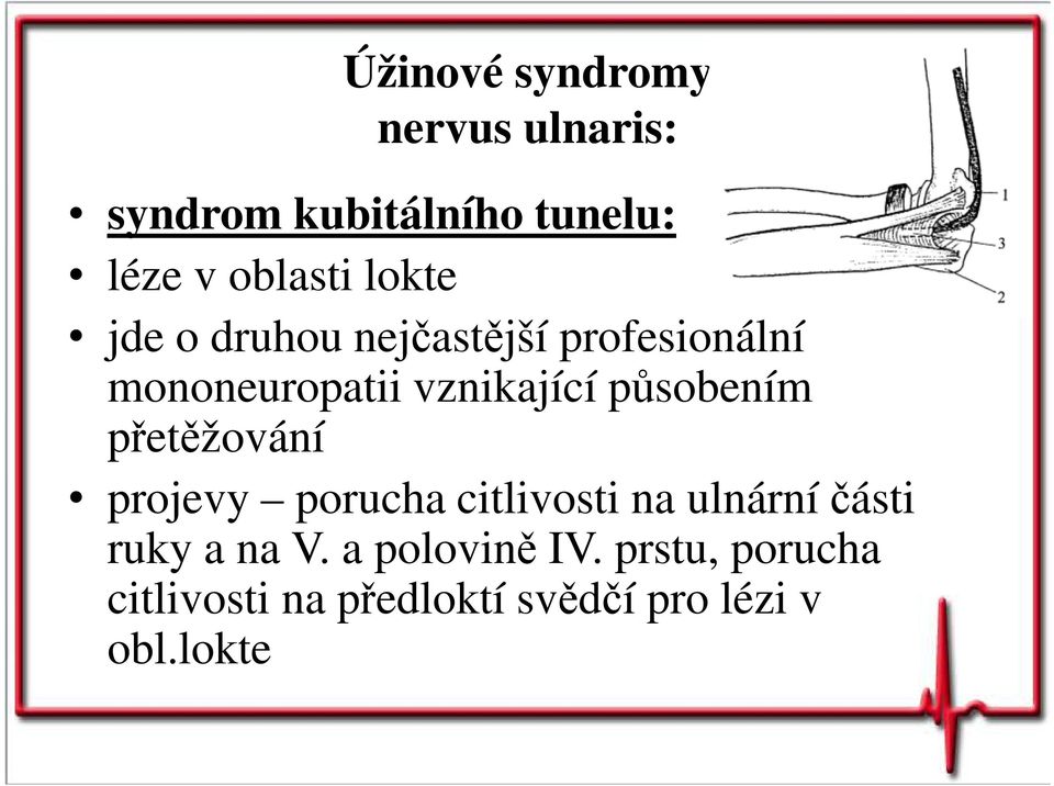 působením přetěžování projevy porucha citlivosti na ulnární části ruky a na