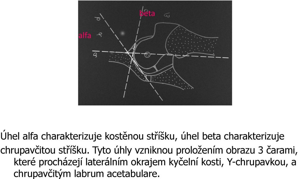 Tyto úhly vzniknou proložením obrazu 3 čarami, které