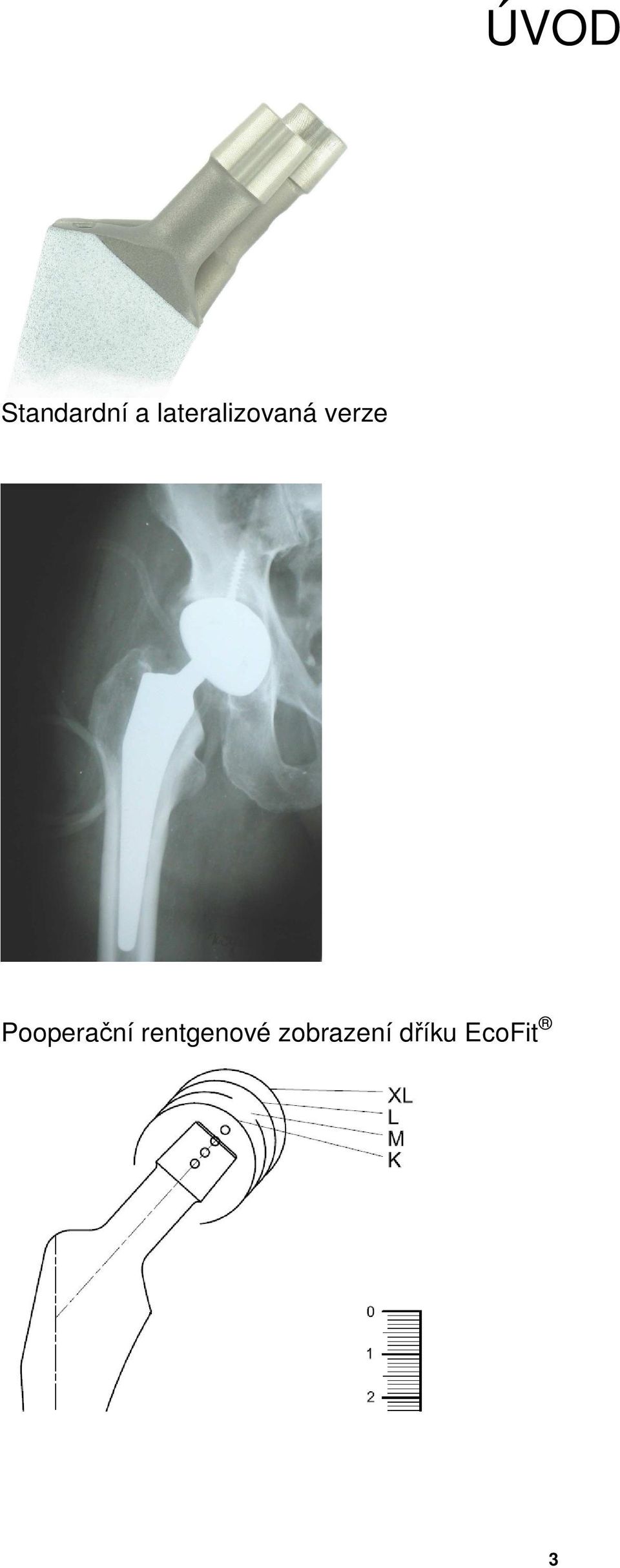 Pooperační rentgenové