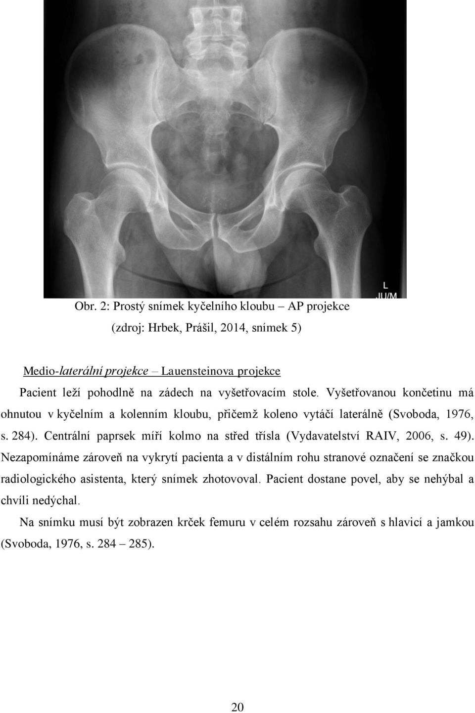 Centrální paprsek míří kolmo na střed třísla (Vydavatelství RAIV, 2006, s. 49).