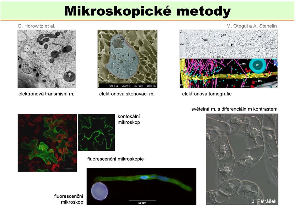 elektronová tomografie konfokální mikroskop světelná m.