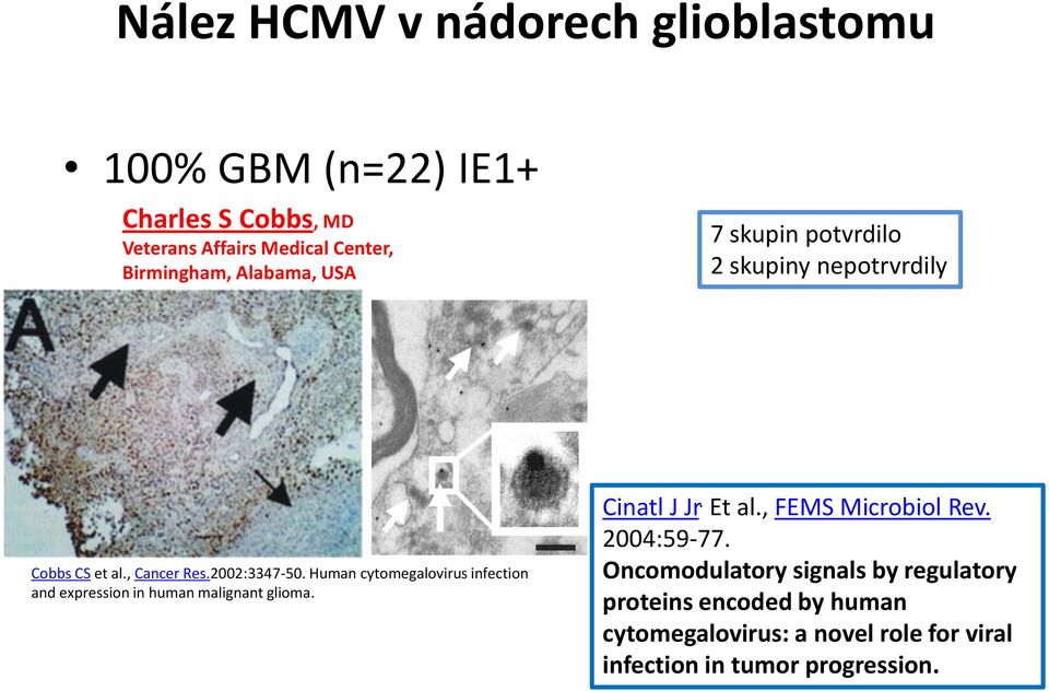 Human cytomegalovirus infection and expression in human malignant glioma. Cinatl J Jr. Et al., FEMS Microbiol Rev.