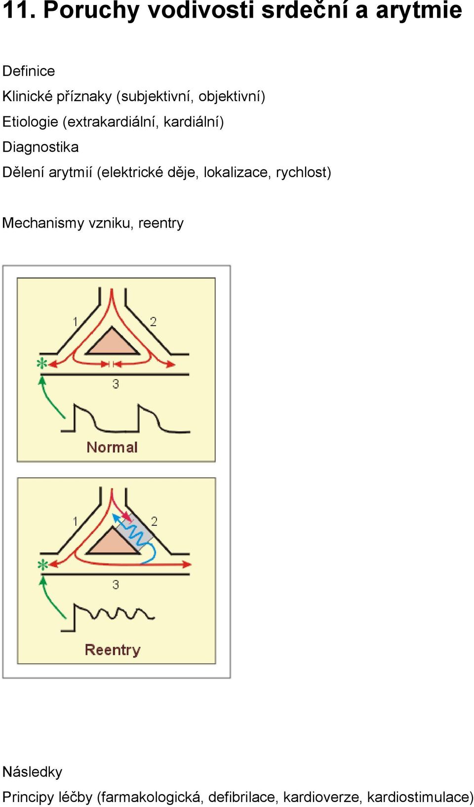 Dělení arytmií (elektrické děje, lokalizace, rychlost) Mechanismy vzniku,