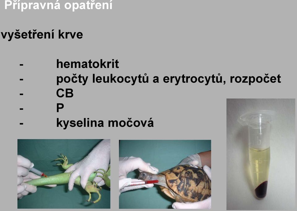 leukocytů a erytrocytů,