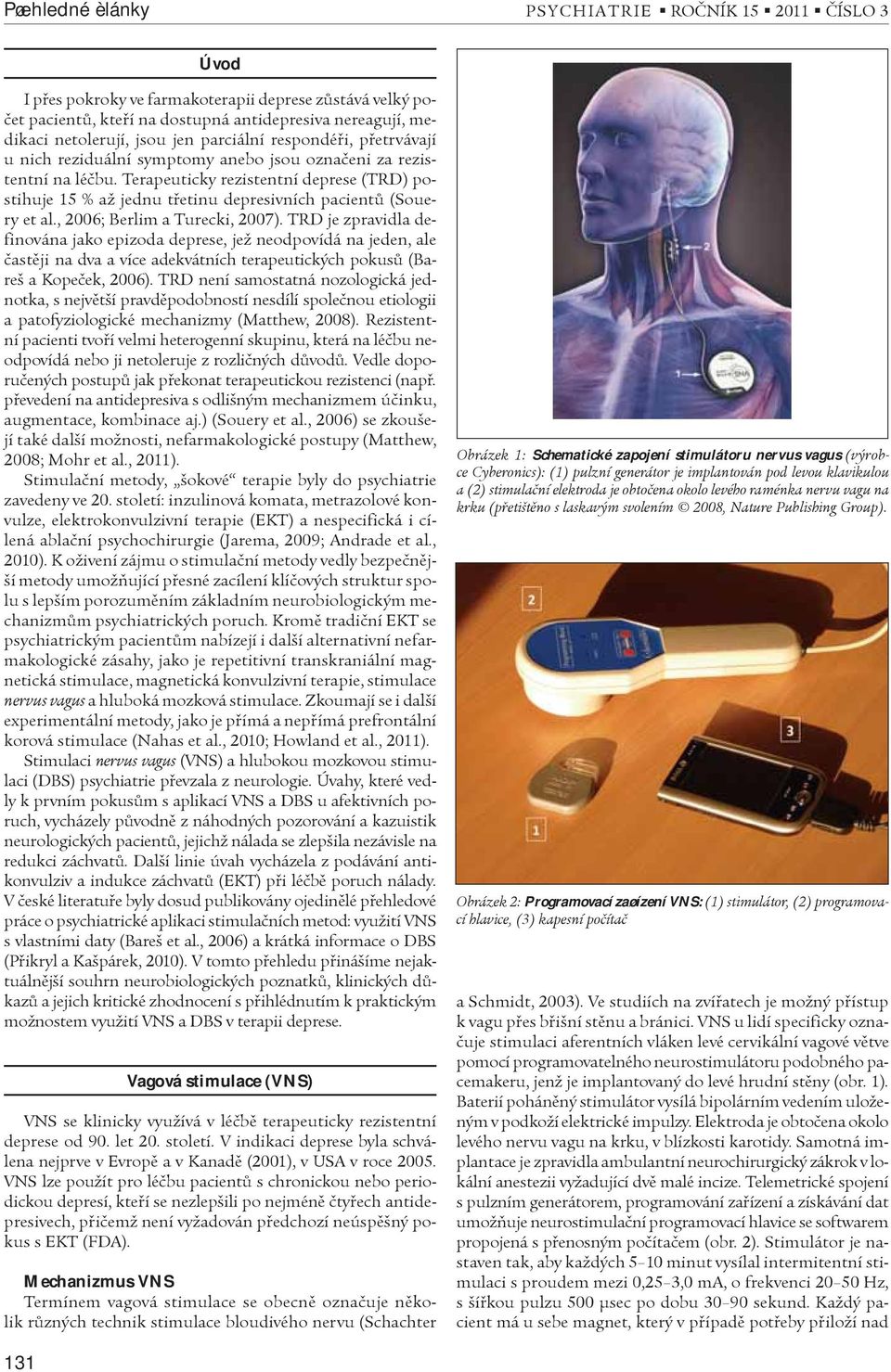Terapeuticky rezistentní deprese (TRD) postihuje 15 % až jednu tøetinu depresivních pacientù (Souery et al., 2006; Berlim a Turecki, 2007).