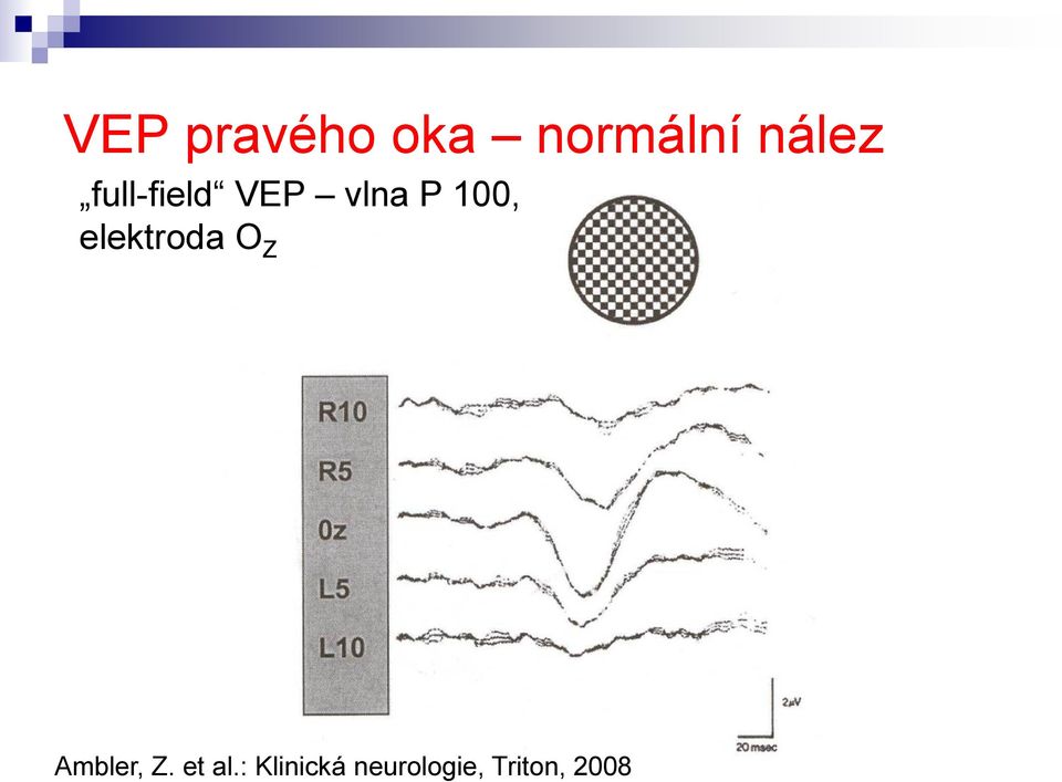 elektroda O Z Ambler, Z. et al.