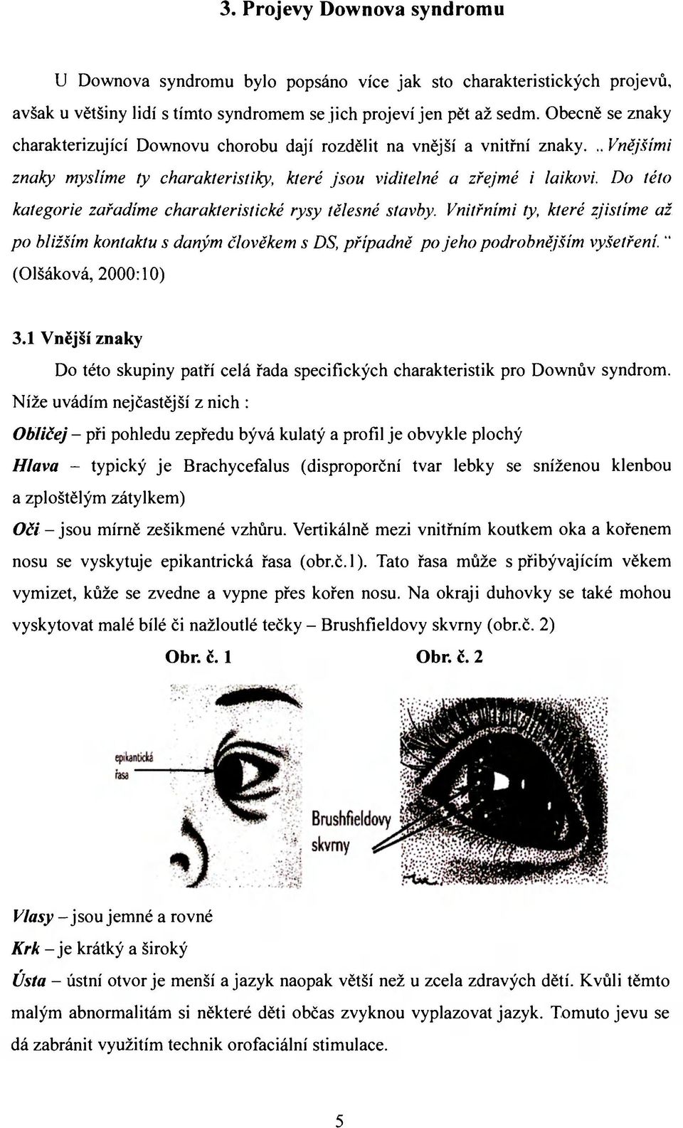 Do této kategorie zařadíme charakteristické rysy tělesné stavby. Vnitřními ty, které zjistíme až po bližším kontaktu s daným člověkem s DS, případně po jeho podrobnějším vyšetření.