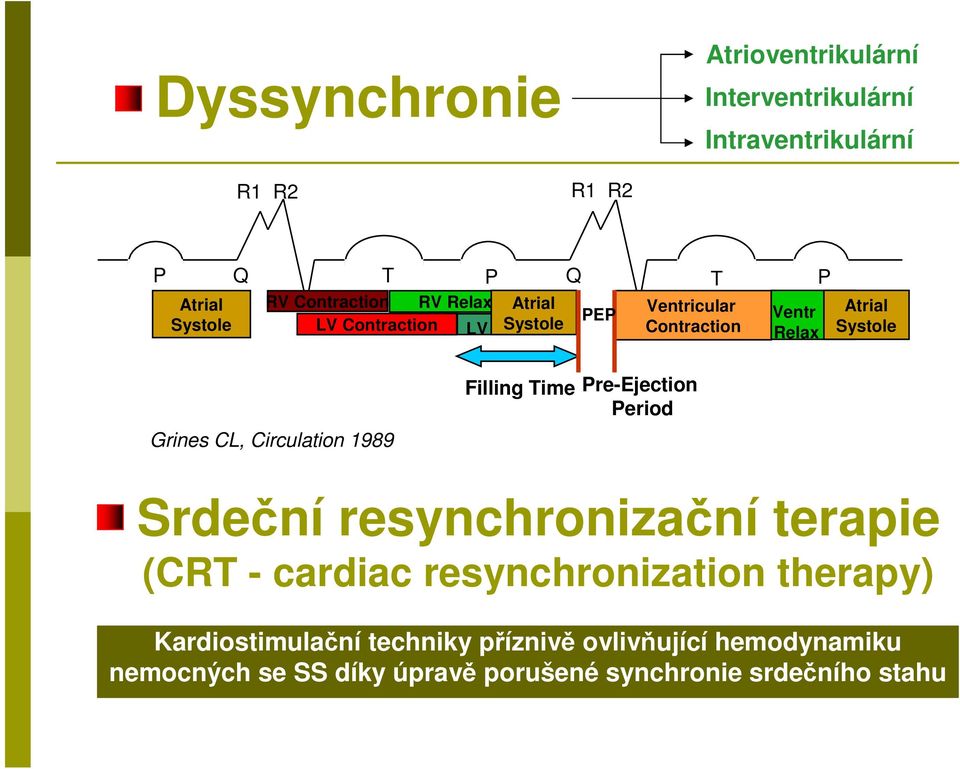Circulation 1989 CRT ON Filling Time Pre-Ejection Period Srdeční resynchronizační terapie (CRT - cardiac resynchronization