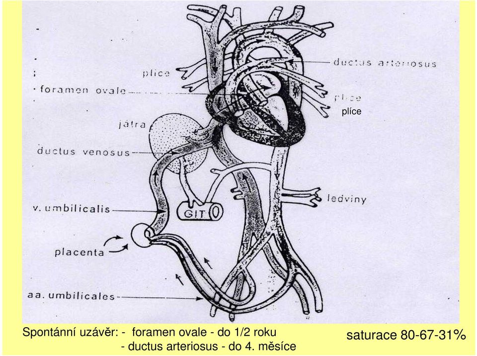 - ductus arteriosus - do 4.