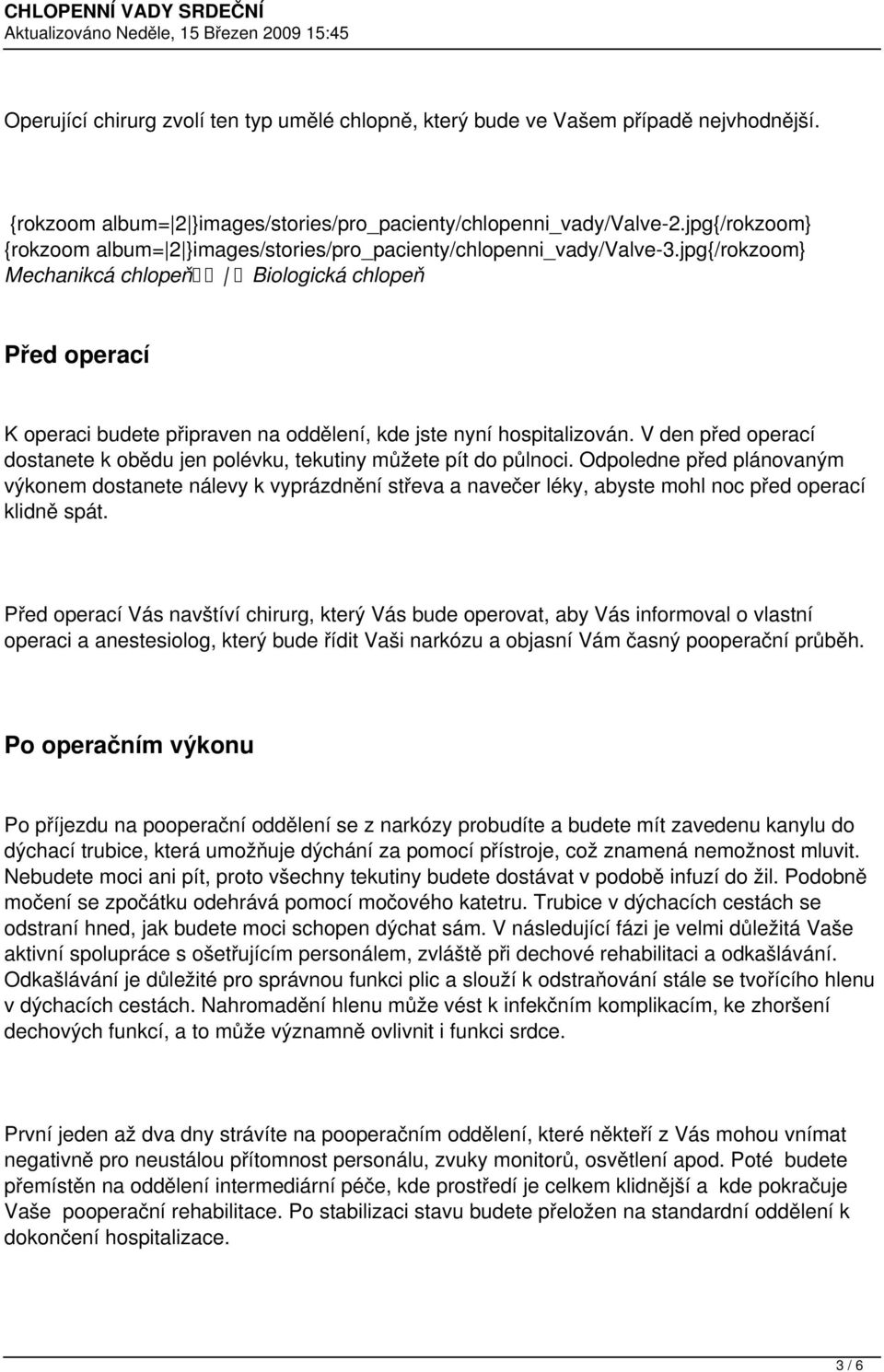 jpg{/rokzoom} Mechanikcá chlopeň Biologická chlopeň Před operací K operaci budete připraven na oddělení, kde jste nyní hospitalizován.